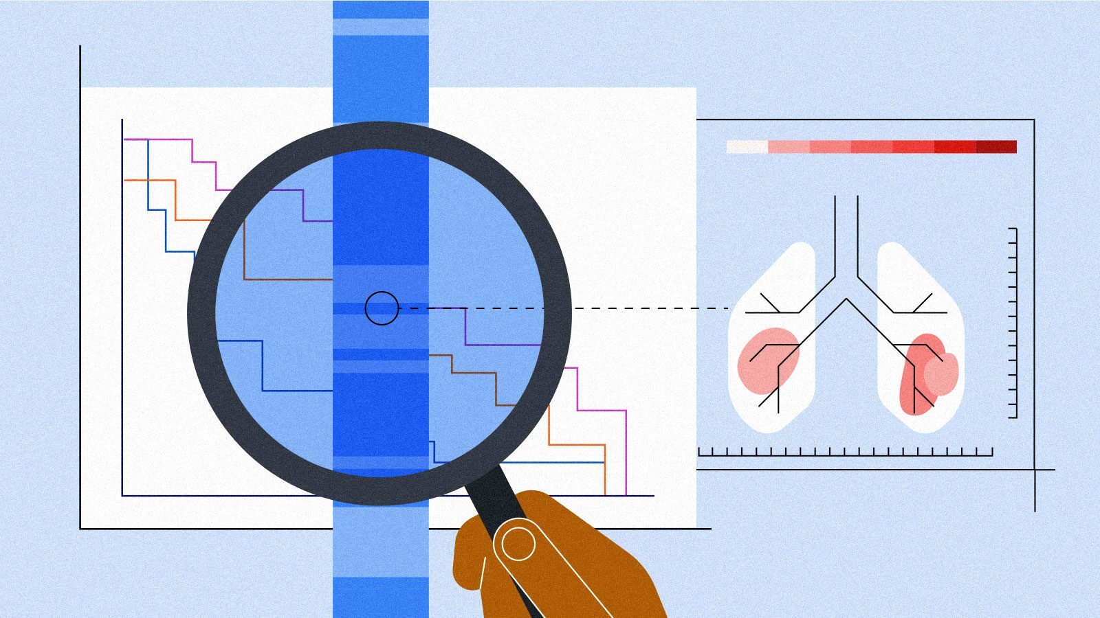 RWE can fill gaps for lung cancer
